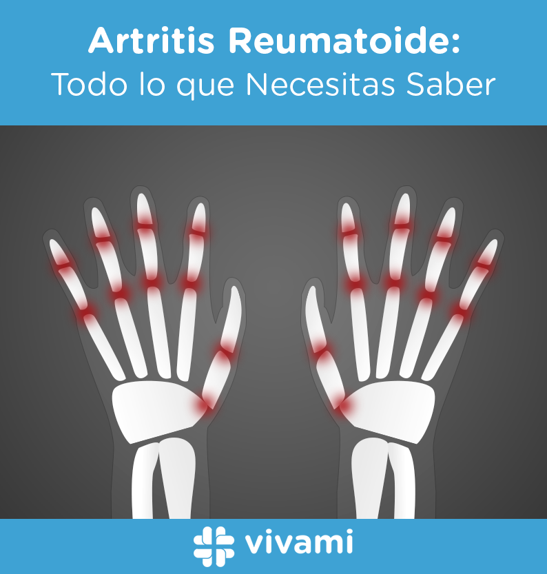 Artritis-Reumatoide_Todo-lo-que-Necesitas-Saber