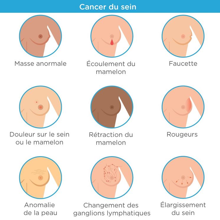 Cancer du sein : comment reconnaitre les symptômes ? - Vivami.co