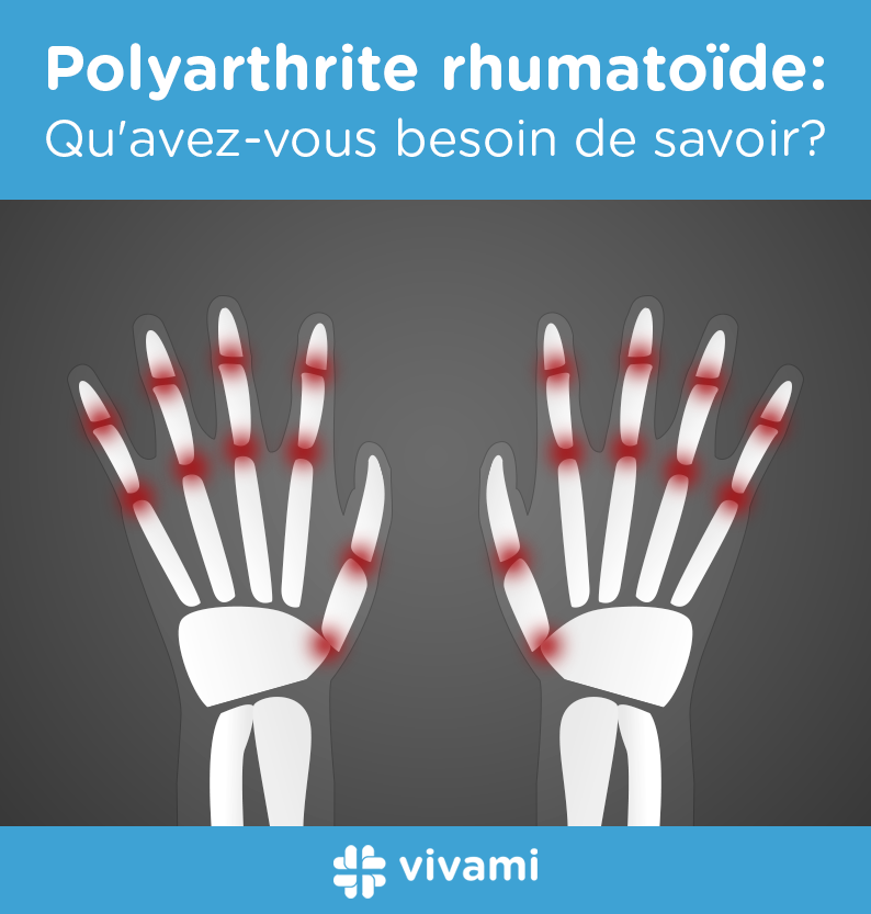 Polyarthrite-rhumatoide